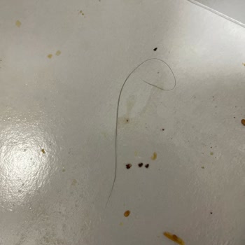 Sipariş Ettiğim Börekten Çıkan Saç Nedeniyle Misafirlerime İkram Edemedim