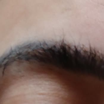 Dilşah Çatkı Beauty İşlem Sırasında Kaşım Ciddi Şekilde Yandı