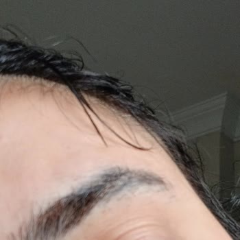 Dilşah Çatkı Beauty İşlem Sırasında Kaşım Ciddi Şekilde Yandı