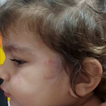 Özel Avcılar Yurdagül Anaokulu Mağduriyeti