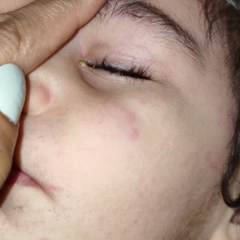 Özel Avcılar Yurdagül Anaokulu Mağduriyeti