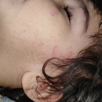 Özel Avcılar Yurdagül Anaokulu Mağduriyeti