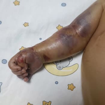 Yoğun Bakımda İhmal Ve Bilgi Eksikliği Oğlumun Hayatına Mal Oldu