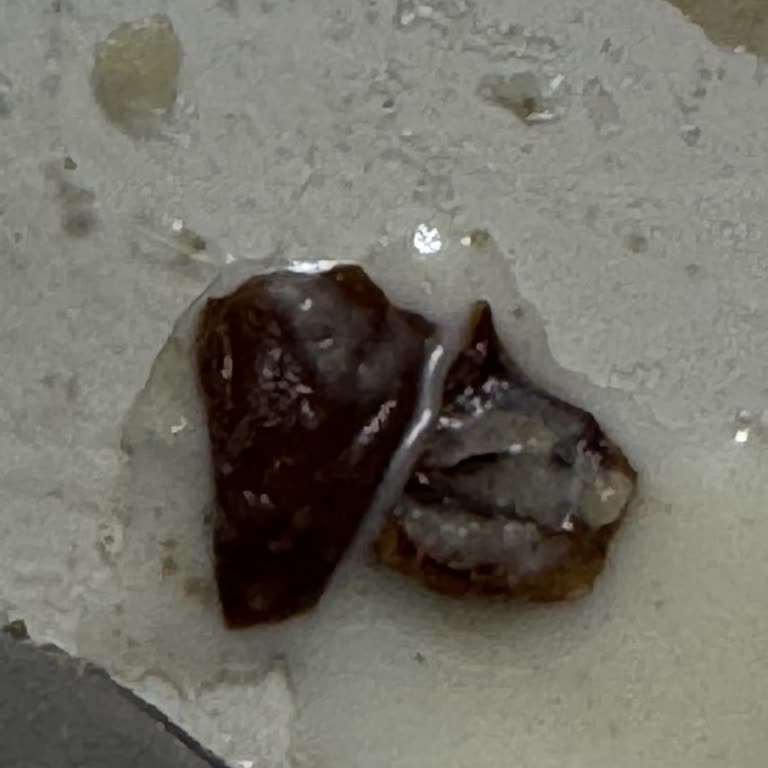 Baklavadan Ceviz Kabuğu Çıktı, Sağlığım Tehlikeye Girdi