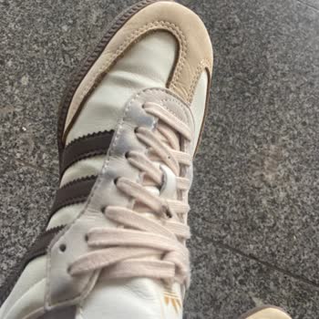 Aldığım Adidas Ayakkabıda Hızlı Deformasyon Ve Yetersiz Garanti Bilgilendirmesi