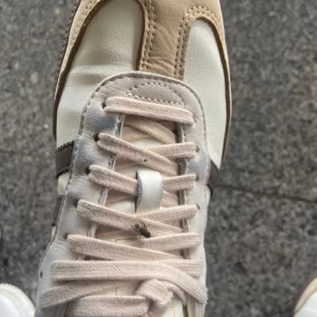 Aldığım Adidas Ayakkabıda Hızlı Deformasyon Ve Yetersiz Garanti Bilgilendirmesi