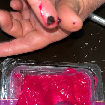 A101 Ejder Meyvesi Tatlısında Sinek Şoku: Sağlık Ve Hijyen Sorunu