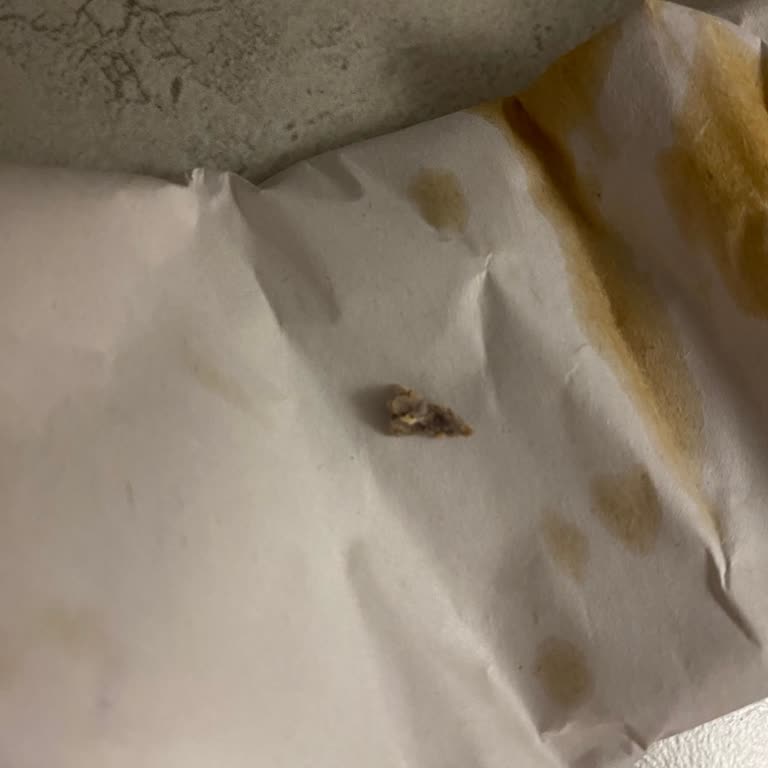 Yemeksepeti Yemek Siparişimde Kemik Çıktı, Ücret İadesi Talebim Reddedildi