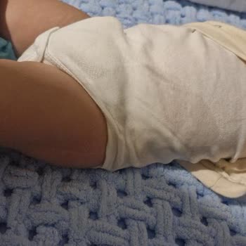 Sleepy Bebek Bezi Yanlardan Sızdırıyor, Müşteri Hizmetleri İlgisiz