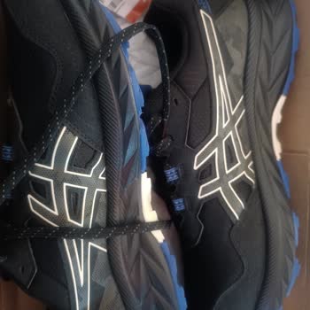 Ayakkabı Kullanımı Sonrası Ayakta Sağlık Sorunları Ve İade Problemi