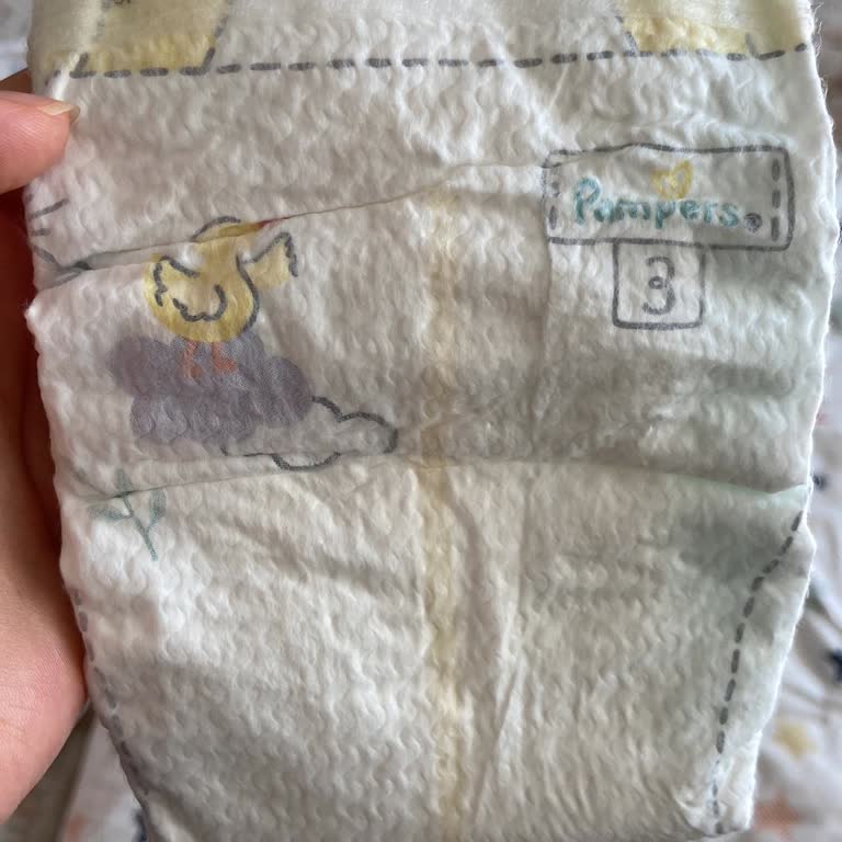 Prima Premium Care Bebek Bezi Yeni Pakette Cilt Sorunu Yaşadık