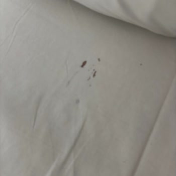 GAP Turu’nda Hijyen Sorunları Ve Otel Mağduriyeti: Para İadesi Talebi