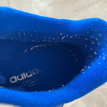 Adidas 2 Haftada Yıpranan Ayakkabı İçin Çözüm Bulunmuyor!