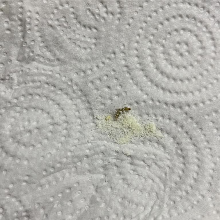 Aldığım Bebek Mamasında Kurt Çıkması Ve Bebeğimde Sağlık Sorunları