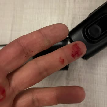 Philips Dikey Süpürge Sürekli Arıza Çıkarıyor Mağduriyet Yaşıyoruz