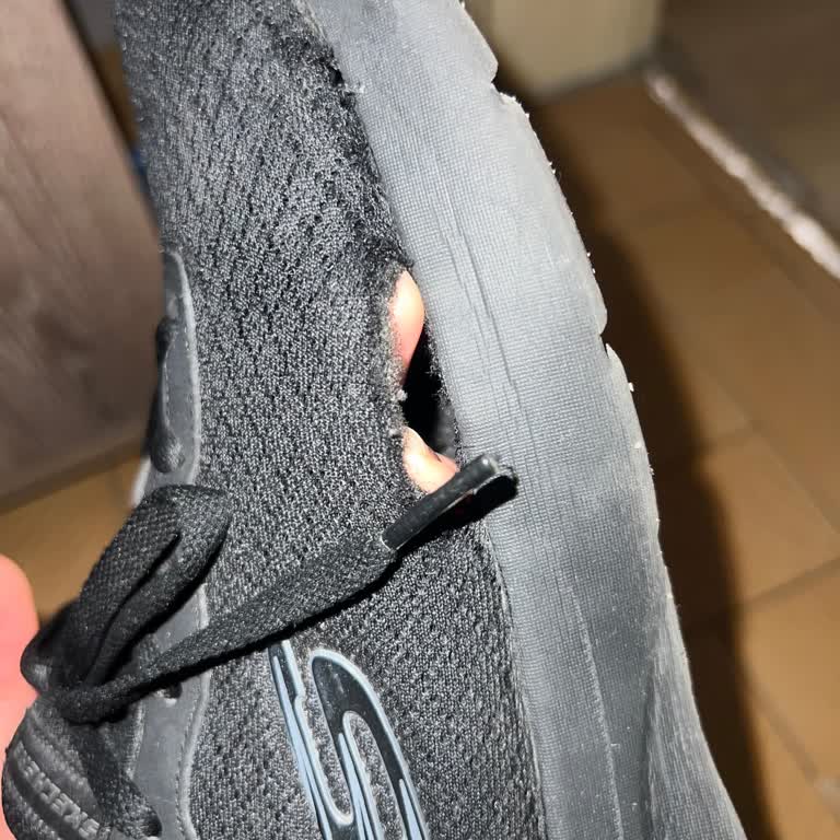 Skechers Eye To Eye Ayakkabıda Kronik Açılma Sorunu Ve İade Reddi