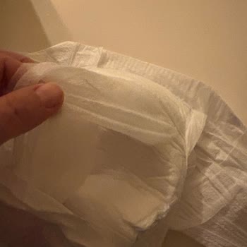 Molfix 6 Numara Bebek Bezinde Üst Tabaka Kalkması Sorunu