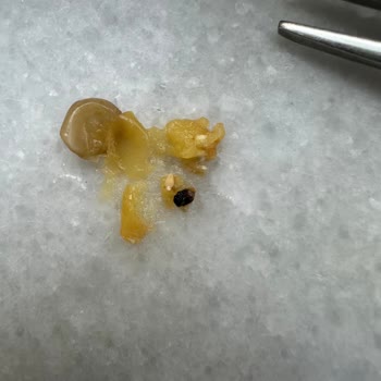 Migros Sanal Market'ten Aldığım Yeşil Mercimekte Böcek Çıkması Ve Hijyen Sorunu