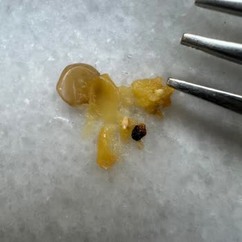 Migros Sanal Market'ten Aldığım Yeşil Mercimekte Böcek Çıkması Ve Hijyen Sorunu