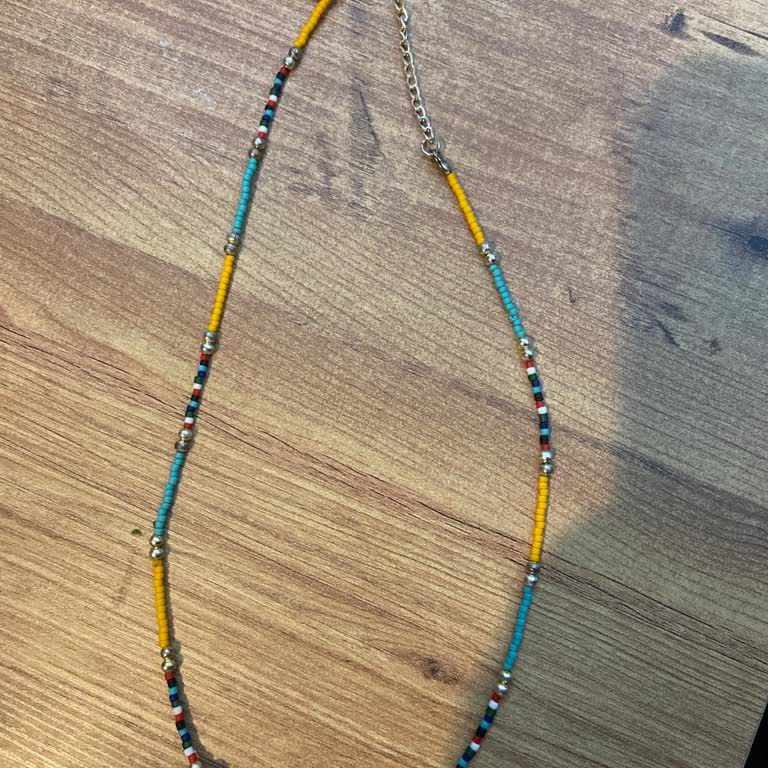 Koton'dan Alınan Kolye Boyunda Alerjik Reaksiyona Sebep Oldu