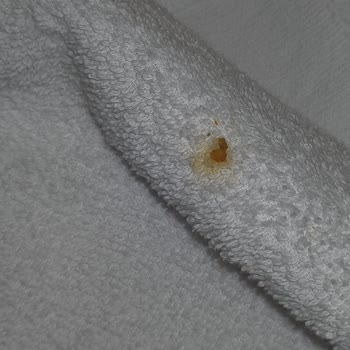 Otelde Ciddi Hijyen Sorunları Ve Haksız Ücret İadesi Reddi