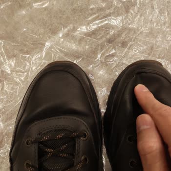 Skechers Ayakkabıda Dikiş Açılması Ve Garanti Reddi