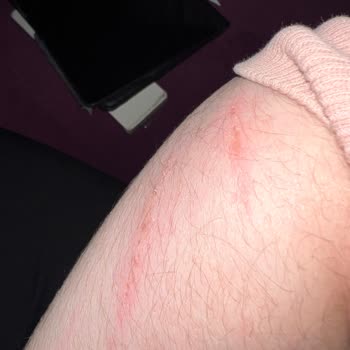 Mavi Su Isı Sistemleri | Fatsa Satış Sonrası Hiçbir Şekilde Teknik Destek Verilmedi