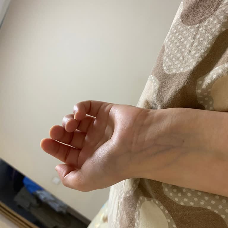 Nivea Deodorant Kullandıktan Sonra Kolumda Kalıcı İz Oluştu Mağduriyetim Giderilmedi