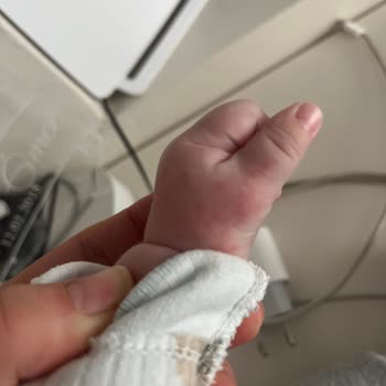 Hipp Organik Devam Sütü Bebeğimde Alerji Ve Sağlık Sorunlarına Yol Açtı