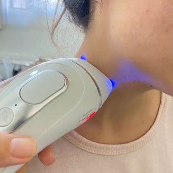Braun Pro3 Epilatörüm Arızalı Elektrik Çarpması Yaşadım Servis Çözüm Sunmuyor