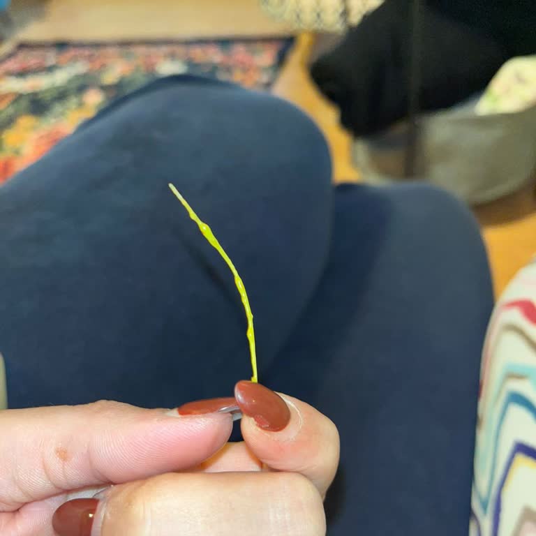 Yemeksepeti Siparişimde Yabancı Cisim Çıktı, Ücret İadem 8 Gündür Yapılmadı Ve Destek Alamıyorum