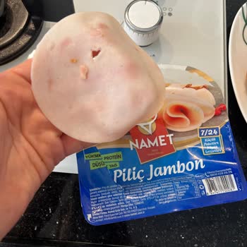 Namet Salamdan Çıkan Kemik Parçası Sağlığımı Riske Attı