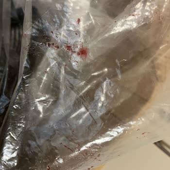 Siparişimde Hasarlı Paket Ve Farklı Marka Sorunu Yaşadım