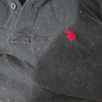 Arçelik Çamaşır Makinesinde Tüylenme Sorunu Ve Yetersiz Destek