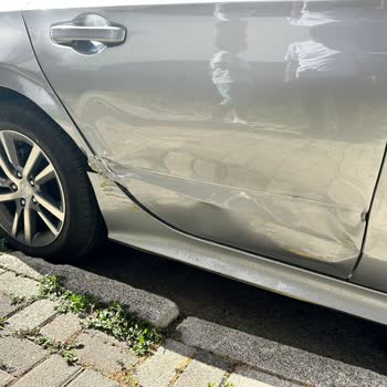 Doğum Günü Hastane Kabusu: Vale Kazası Sonrası Mağduriyet Ve Karşılanmayan Zarar