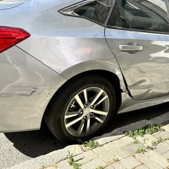 Doğum Günü Hastane Kabusu: Vale Kazası Sonrası Mağduriyet Ve Karşılanmayan Zarar