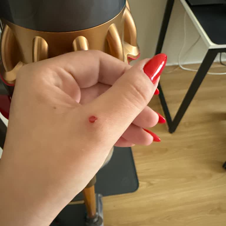 Dyson V15 Tutma Yeri Eli Tahriş Ediyor Müşteri Hizmetleri Çözüm Sunmuyor