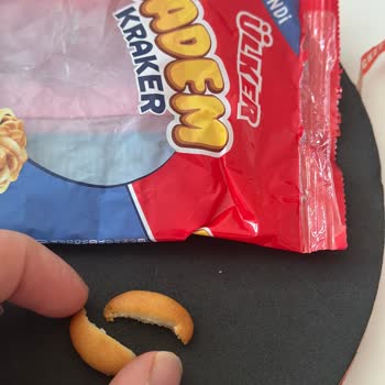 Krakerin İçinden Saç Çıktı, Sağlığım Tehlikeye Girdi!