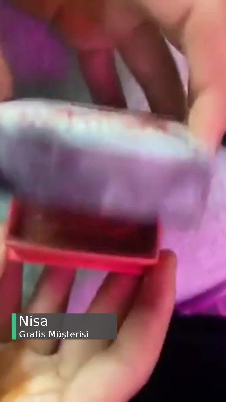 Gratis Allığım Kırık Geldi videonun kapak resmi
