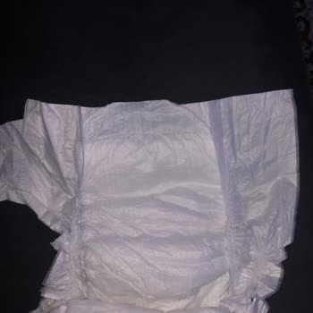 Molfix Bebek Bezinde Üretim Hatası Ve Müşteri Hizmetlerine Ulaşılamaması