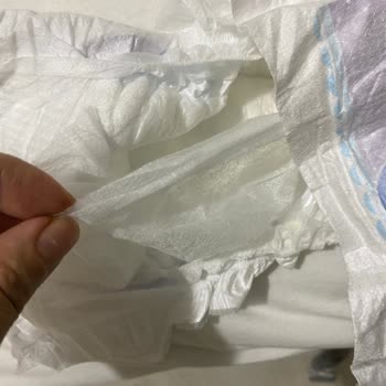 Aldığım Molfix Bezler Kullanılamaz Hale Geldi, Mağduriyetimin Giderilmesini İstiyorum