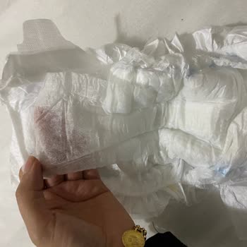 Aldığım Molfix Bezler Kullanılamaz Hale Geldi, Mağduriyetimin Giderilmesini İstiyorum