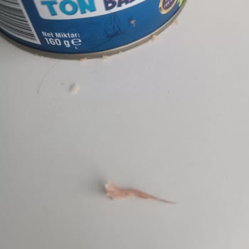 Derya Ton Balığı Ton Balığında Çıkan Büyük Kılçık Sağlığımı Tehlikeye Attı