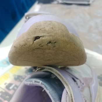 Kısa Sürede Deforme Olan Disney Frozen Ayakkabı Ve İade Talebimin Reddedilmesi