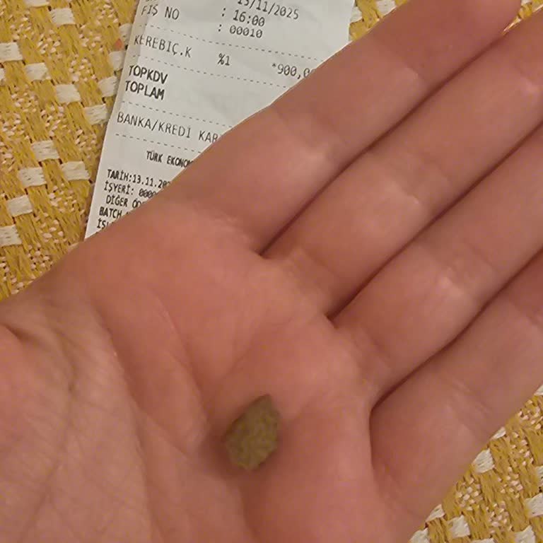 Aldığım Kerebiçin İçinden Taş Çıkmasıyla Yaşadığım Hayal Kırıklığı