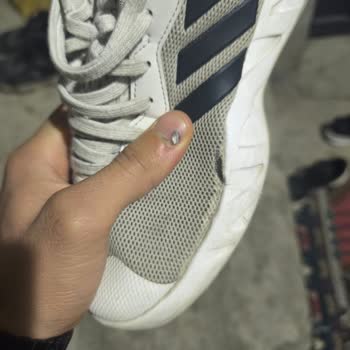 FLO'dan Aldığım Adidas Ayakkabı Hem Yırtıldı Hem De Orijinalliğinden Şüpheliyim