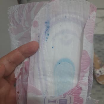 Orkid Platinum Pedlerde Mavi Boya Lekesi Şikayeti