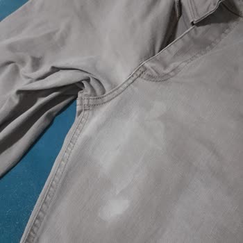 Leke Sihirbazı Pantolonun Rengini Attı, Mağduriyetimin Giderilmesini İstiyorum