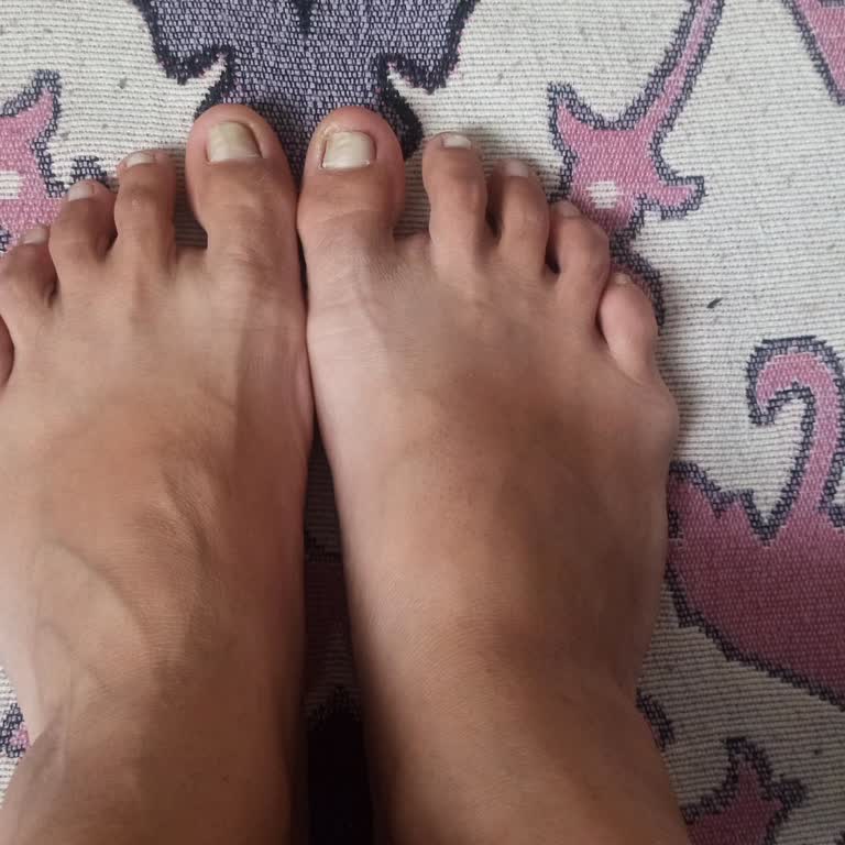 Aldığım Reebok Ayakkabının Teki Dar Çıktı Mağaza İlgisiz Kaldı