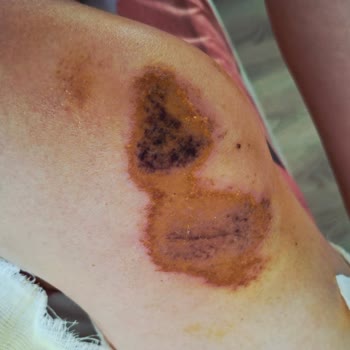 Urent Дтп С Несовершеннолетним, не отвечают на мою жалобу